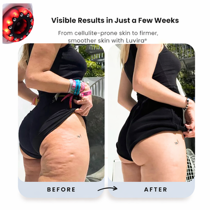 Luvira™ GlowSculpt